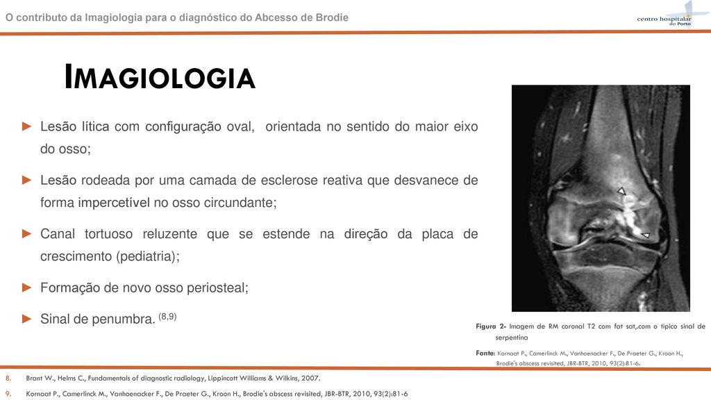 O contributo da Imagiologia para o diagn stico do Abcesso de